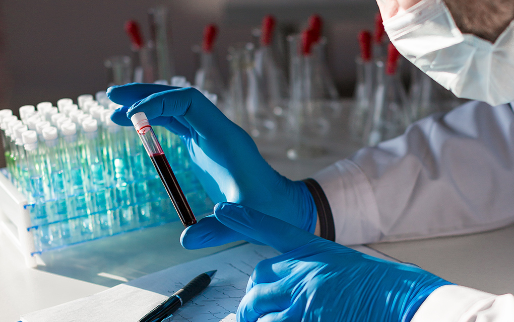 Este es el avance que lleva la UAQ en la vacuna contra el coronavirus