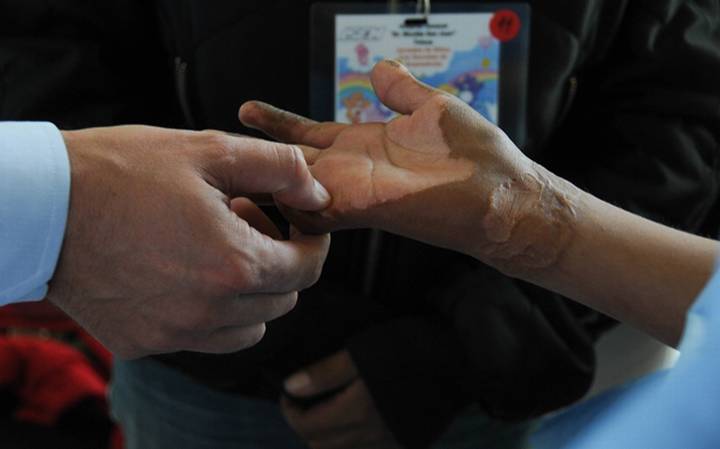 Medidas como mantener los pisos secos y guardar objetos peligrosos ayudan a prevenir accidentes en el hogar durante las vacaciones.